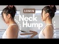 10min Fix Neck Hump Forward Head Correct Posture Best Neck Stretch