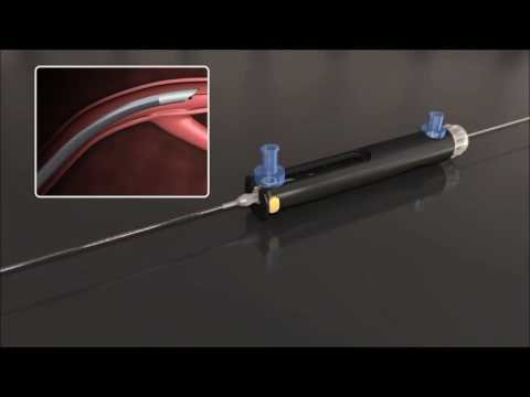 CenterCross ULTRA by Roxwood Medical