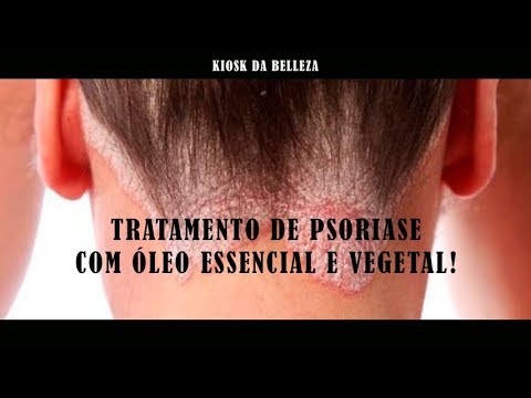 Como é possível tratar a psoríase em uma cara Remédios de gente de crianças de tratamento de neurodermatitis