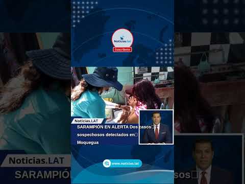 SARAMPIÓN EN ALERTA: Dos casos sospechosos detectados en Moquegua