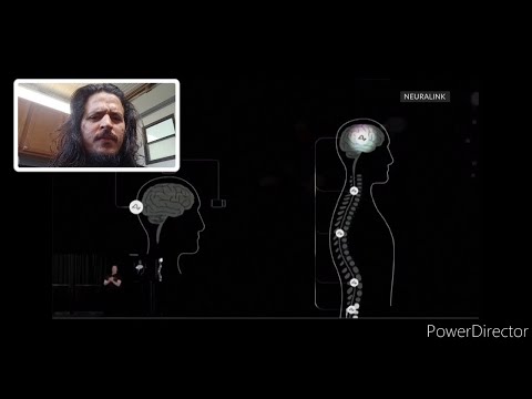 Elon Musk Presents "Neuralink" His Brain Implant Idea! (Reaction/RAWMT)