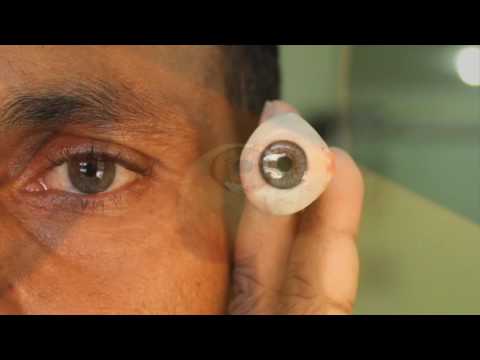 Best Artificial Eye Center in Delhi