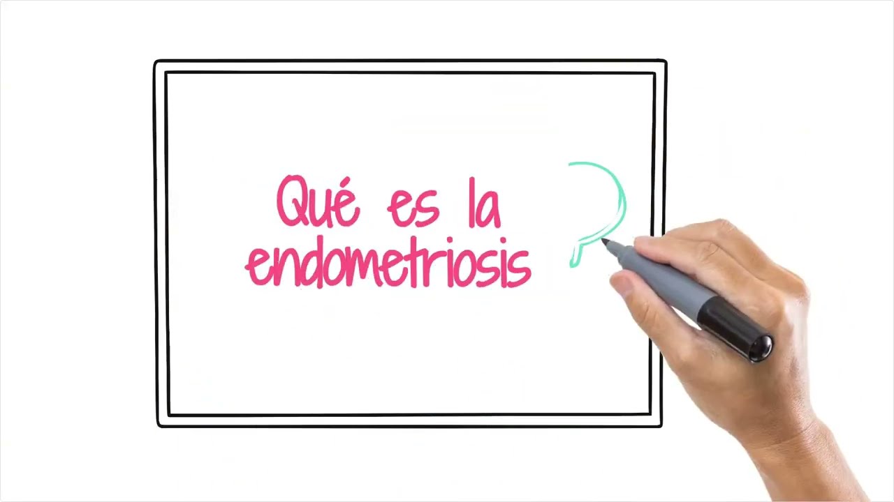 Thumbnail for Definición