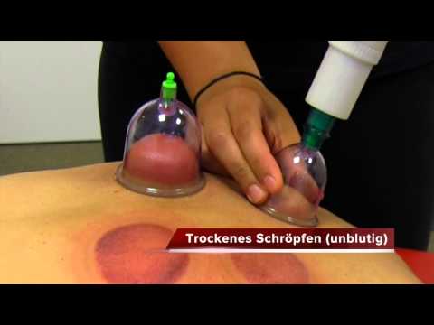 Kann bei einem kranken Magenschmerzen spinnen Joint in Kiew
