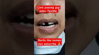 Download lagu cara pasang gigi palsu flexible #gigi #flexibledenture #gigitiruan #valplast #sorts #youtube mp3 Download lagu cara pasang gigi palsu flexible #gigi #flexibledenture #gigitiruan #valplast #sorts #youtube mp3