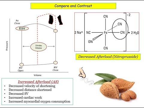 12DaysinMarch, Valvular Heart Disease #7, Aortic Stenosis for the USMLE Step One Exam