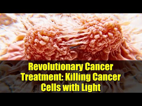Revolutionary Cancer Treatment: Killing Cancer Cells with Light