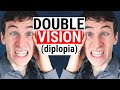 What Causes DOUBLE VISION (Diplopia) | 5 Common Causes for Diplopia | Doctor Eye Health