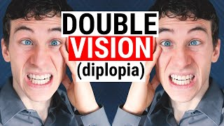 What Causes DOUBLE VISION (Diplopia) | 5 Common Causes for Diplopia | Doctor Eye Health