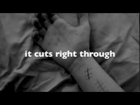 Scars by Colton Dixon
