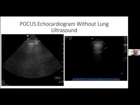 Webinar: Point of Care Echocardiography in Critical Care