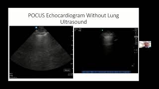 Point-of-Care Echocardiography in Critical Care