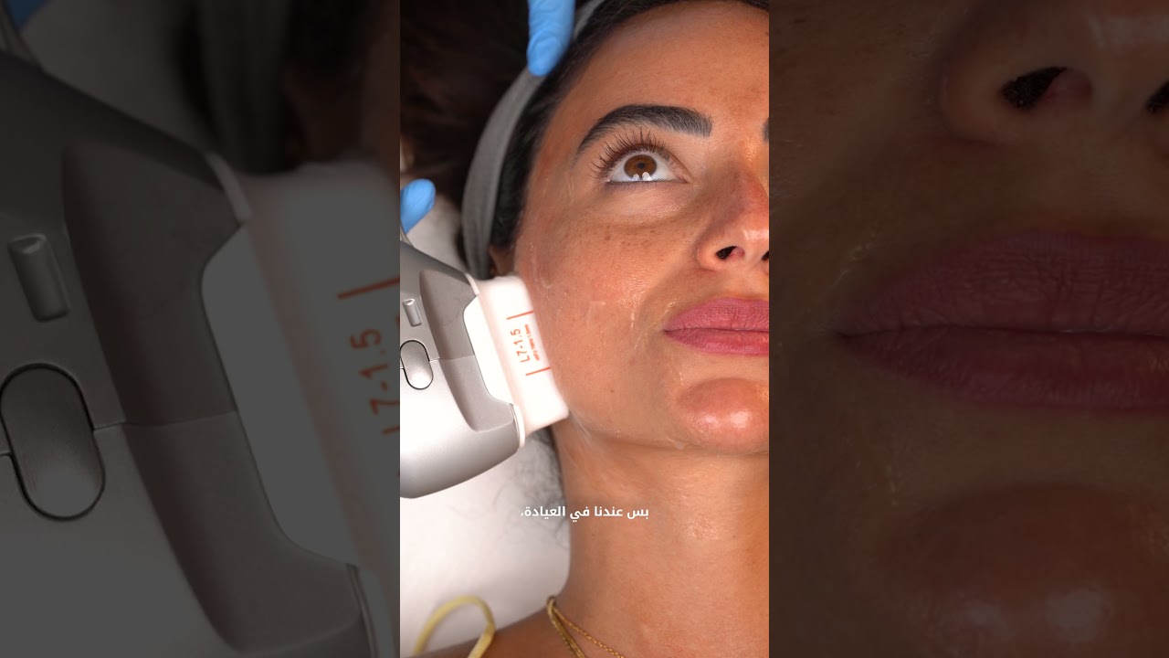 Hifu Procedures and Misconception thumbnail