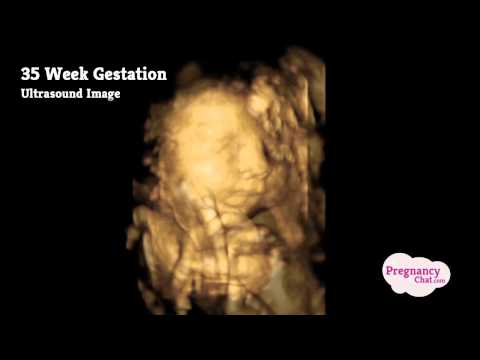 "35 Weeks Pregnant" by PregnancyChat.com @PregChat