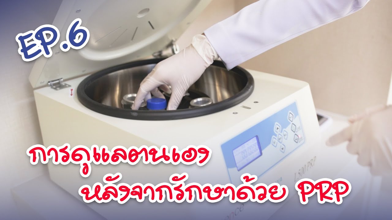 การดูแล หลังจากฉีด PRP | EP.6