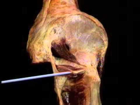 Cè una disabilità danno osteocondrosi a Terapia fisica complessa in una malattia comune