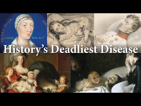 Royals who Died from Tuberculosis