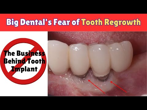 Unveiling Big Dental's Fear of Tooth Regrowth | Medical Miracle