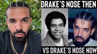 Drake Responds To Rick Ross' Saying He Got A Nose Job... I Would Get A 2 For 1 Deal With My Mom
