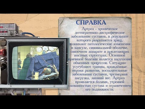 «История болезни». Артроз