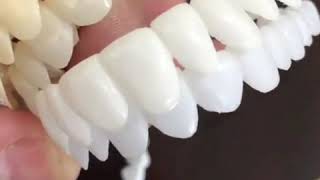 Snap On Smile Oujda