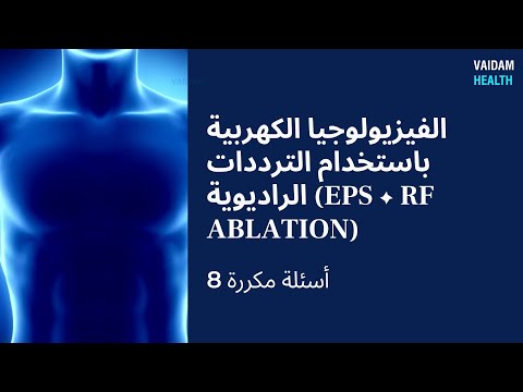 الأسئلة المتداولة حول اجتثاث