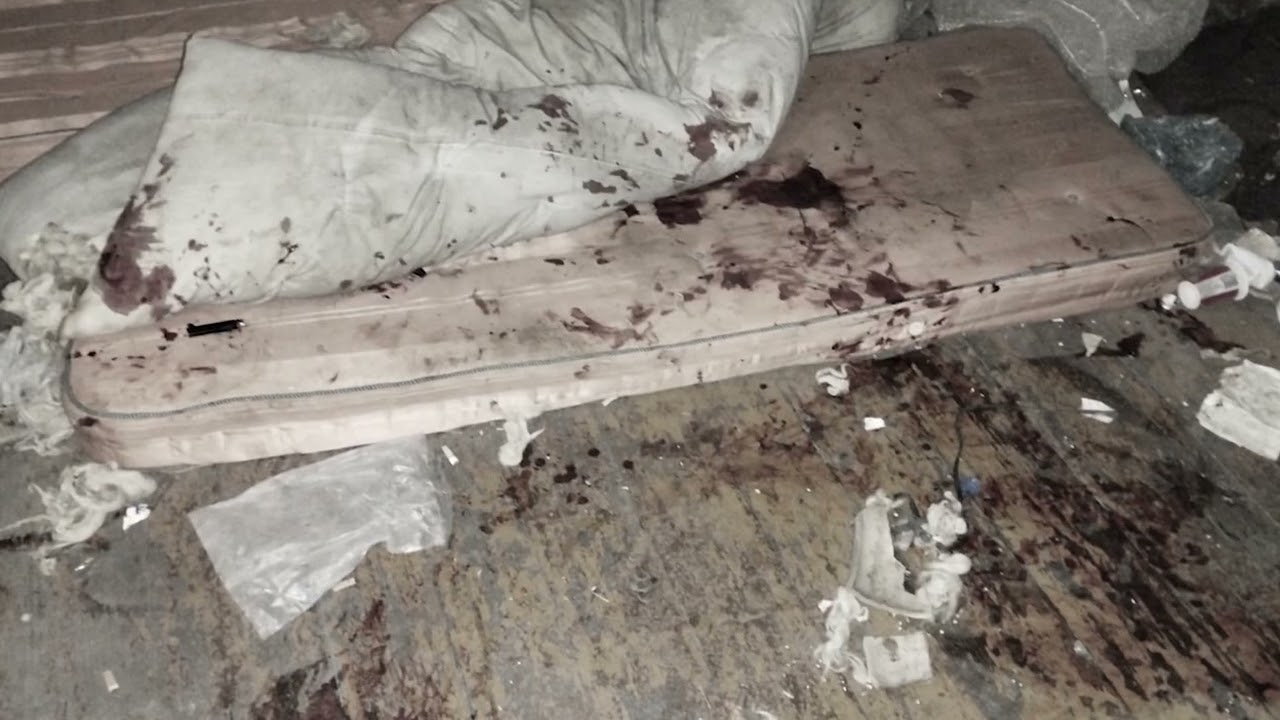 Տաշիրում ծեծի ենթարկված տղամարդը Երևանում մահացել է. մեկ անձ կալանավորվել է