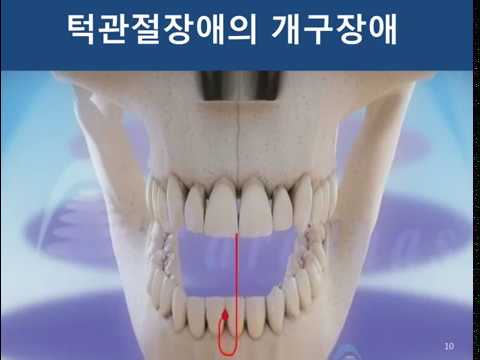 턱관절과 전신 건강의 연결