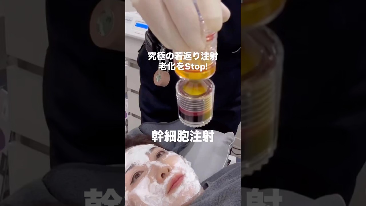 62歳本気で若返り目指します！幹細胞注射 #美容 #韓国美容 #アンチエイジング @ajunmatv