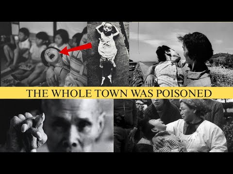 Minamata Mercury Disaster and the 'Dancing Cat Disease¨ of Japan