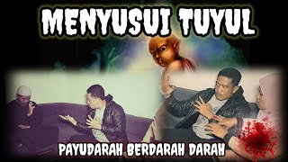 Download lagu SUDAH BERDARAH DARAH,AKIBAT MENYUSUI TUYUL..MASIH SAJA KERAS KEPALA. mp3