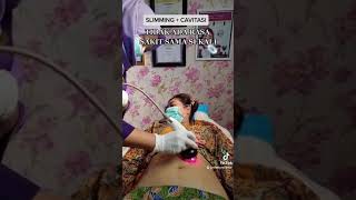 Download lagu RF perut   cavitasi #slimming#Rfslimming#skincare#bojonegoro mp3