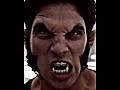 Stiles Spoils The Game Teen Wolf Shorts