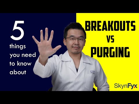 Breakout Vs Purging | 5 things to know