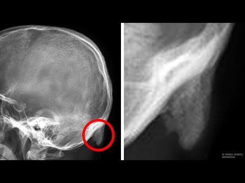 ガジェットがついに私たちの体型を変えた方法 (How Gadgets Have Finally Changed Our Body Shape)