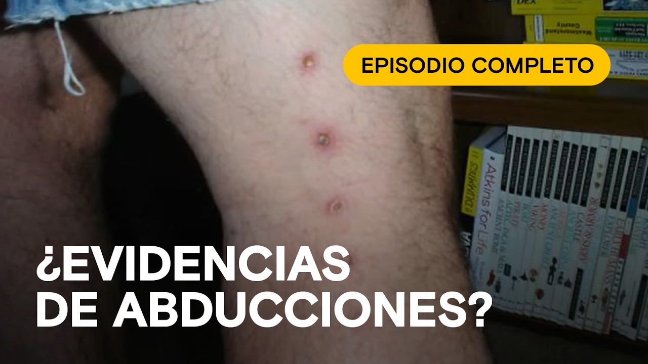 👽👨‍🦳 Historias de ABDUCIDOS en primera persona 😲 ¡Evidencia asombrosa! 🛸 Episodio completo