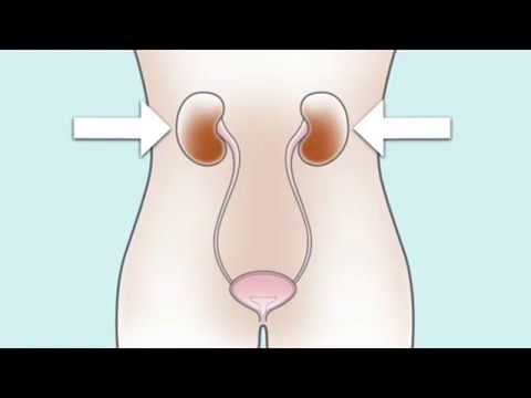 Coloplast | Zelfkatheterisatie meisjes