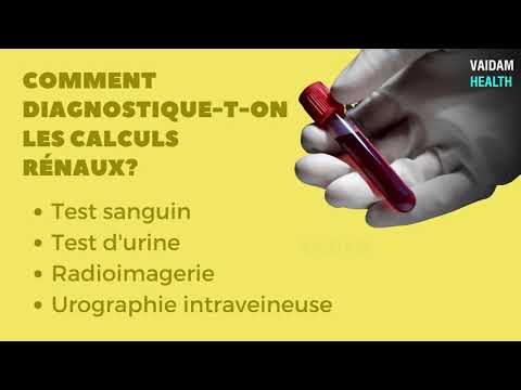 Calculs rénaux