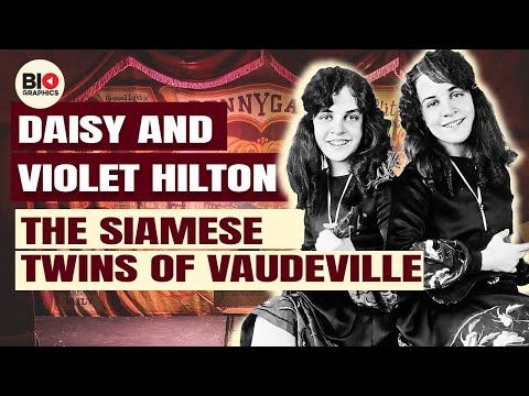 Daisy and Violet Hilton: The Siamese Twins of Vaudeville
