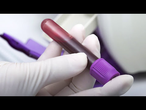 PSA Test for Prostate Cancer