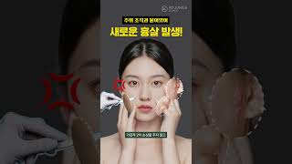 [ENG] 거상 수술 후 부작용, 흉살 유형과 치료 방법