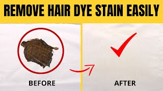 How to Get Hair Dye Out of Clothes at Home with Vinegar
