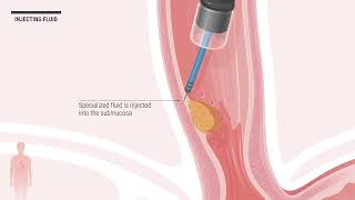 Peak Gastroenterology Associates