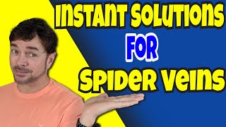 Quick Ways To Solve SPIDER VEINS   | Chris Gibson #shorts