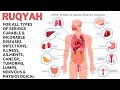 Ruqyah For All Types Of Serious Curable Incurable Diseases Infections Illness Cancer Tumorms Lumps