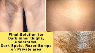LIGHTEN DARK INNER THIGHS, UNDERARMS, NECK, DARK SPOTS + BUMPS ON PRIVATE AREA 100% (NATURAL REMEDY)