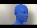Video of Cochlear Hydrops (What Happens in the Inner Ear)