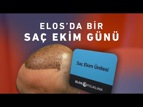 Elos Klinikte Saç Ekimi