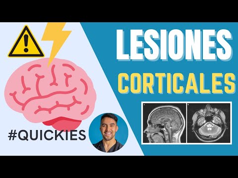 LESIONES CORTICALES RESUMEN