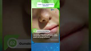 Jangan Panik, Ini Beberapa Langkah Tepat untuk Mengatasi Mimisan yang Tak Terduga